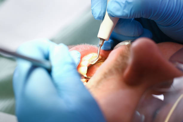 Best Pediatric Emergency Dentist in Harbor Hills, OH